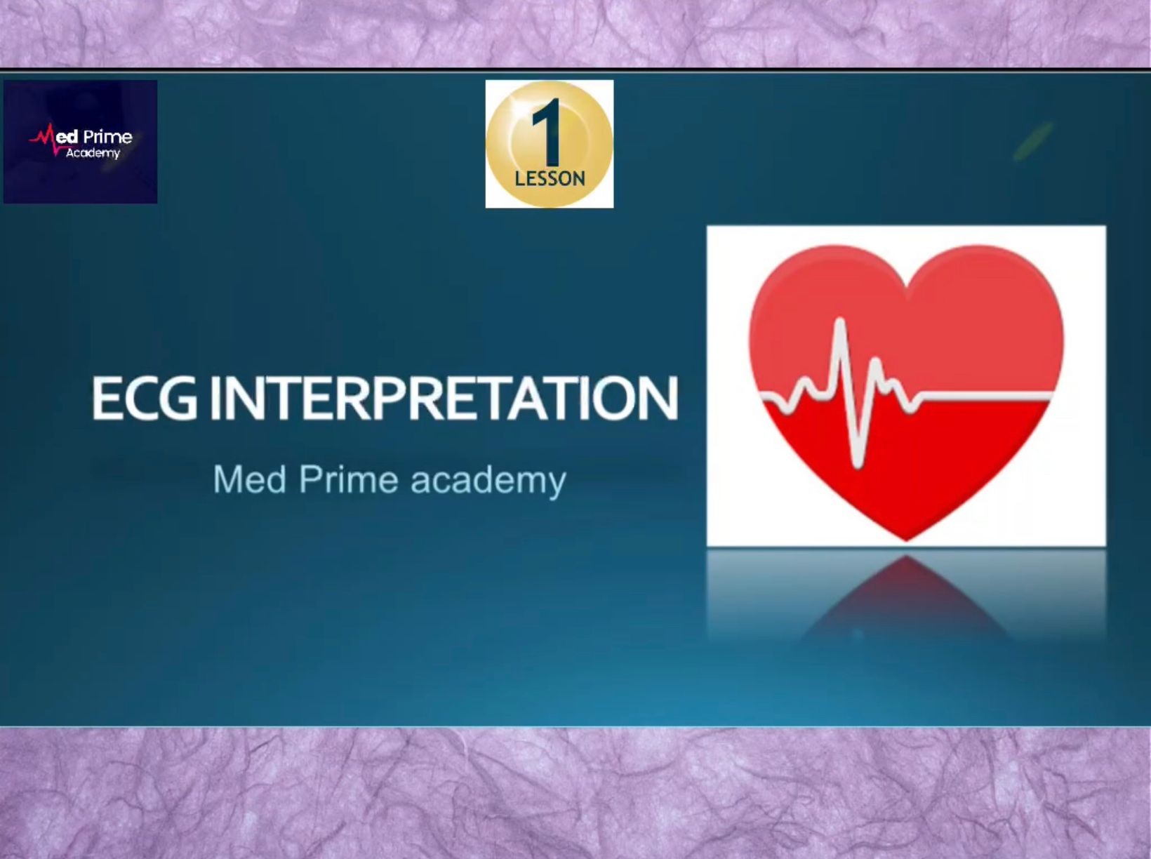 In this lesson, we will learn the definition of ECG, History and some indications of the ECG exam